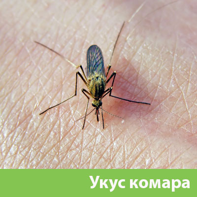 Укусы комаров в Йошкар-Оле