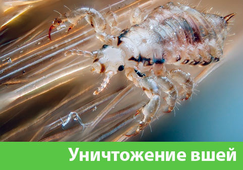 Уничтожение вшей в городе Йошкар-Ола